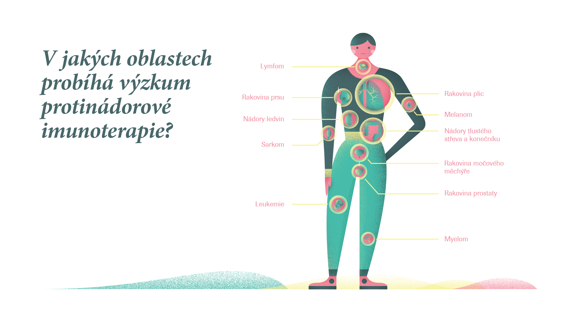 V jakých oblastech probíhá výzkum protinádorové imunoterapie?