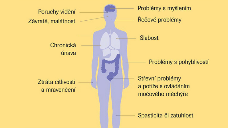 Que significa que el cuerpo entre en cetosis